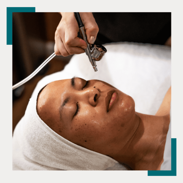 Hydro Facial: oxygen infusion